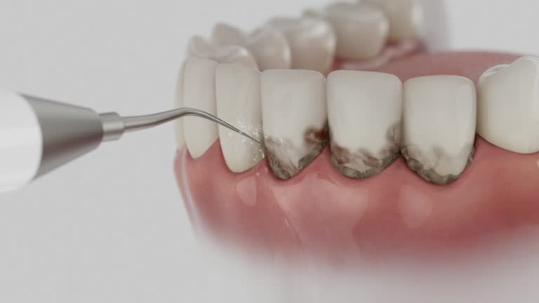 Reliable Dental Implants contractor in Sebring, OH by Smile Center Dentistry